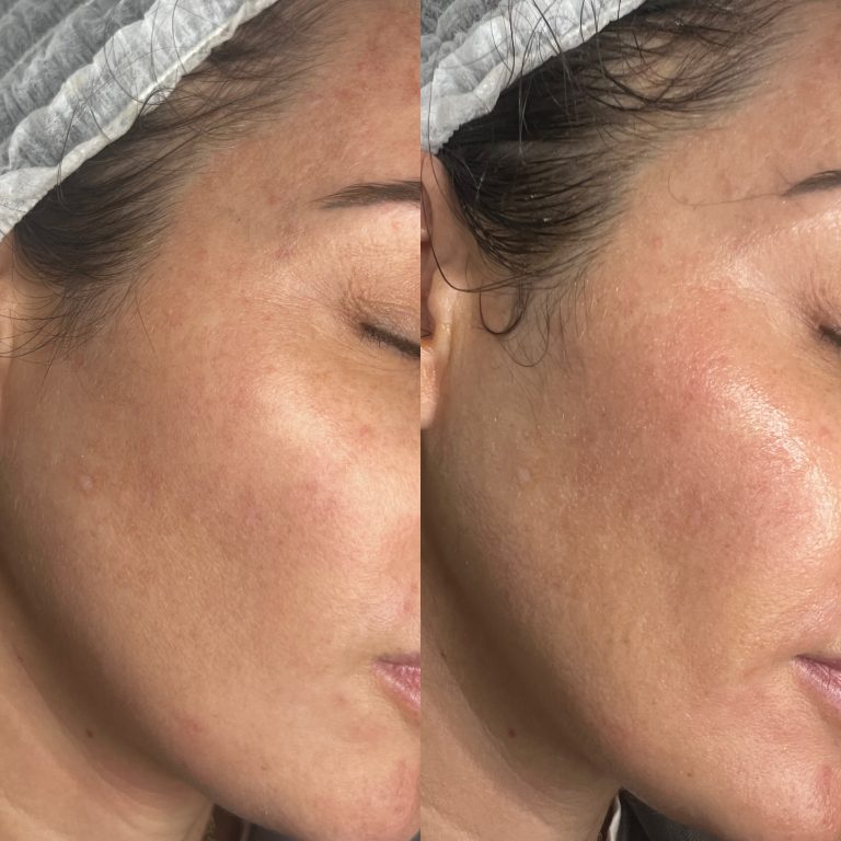Before & After