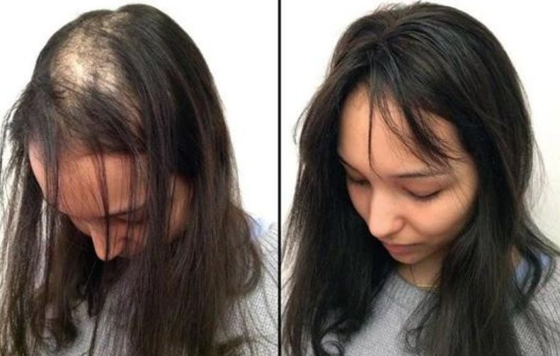 Before & After