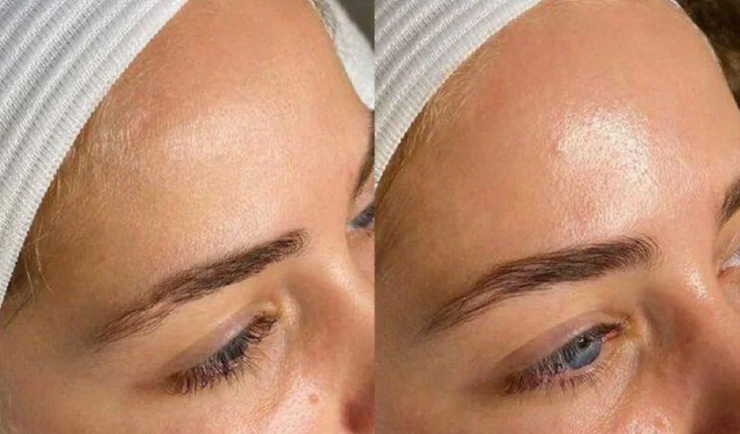 Before & After