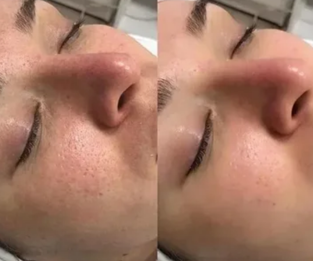 Before & After