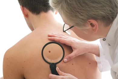 Genital Skin Rashes & Conditions in men