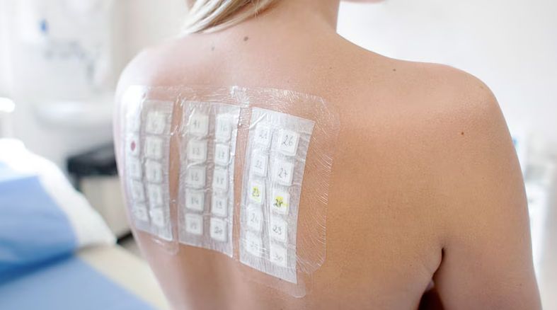 Skin Allergies & Patch Testing